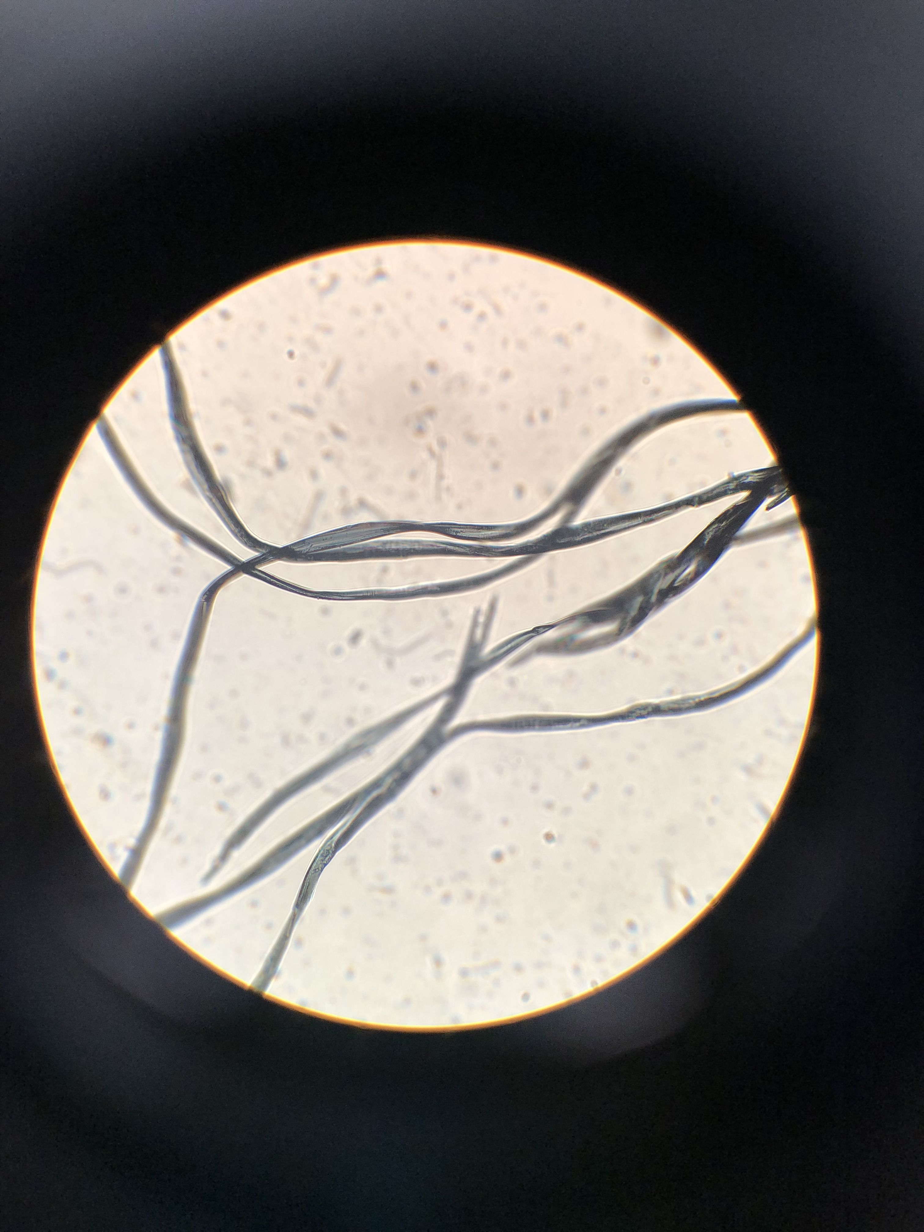 A circular microscope image of some thin threads